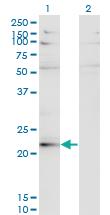 Anti-LBX2 Mouse Monoclonal Antibody [clone: 3A5]