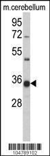 Anti-GGPS1 Rabbit polyclonal antibody