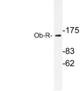 Western blot analysis of lysate from COLO cells using Anti-Ob-R Antibody