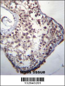 Anti-GLCCI1 Rabbit Polyclonal Antibody (HRP (Horseradish Peroxidase))