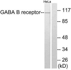 Antibody anti-GABA-B receptor 100 µg