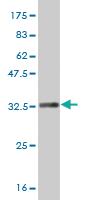 Anti-ERCC1 Mouse Monoclonal Antibody [clone: 3A7]