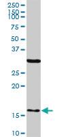 Anti-FIS1 Mouse Monoclonal Antibody [clone: 1G9]