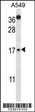 Anti-CSTA Rabbit Polyclonal Antibody (AP (Alkaline Phosphatase))