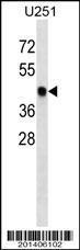 Anti-SNX6 Mouse Monoclonal Antibody (APC (Allophycocyanin)) [clone: 335CT6.4.6]