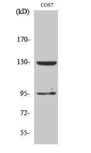 Antibody anti-GABA-B receptor 100 µg