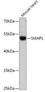 Western blot analysis of extracts of Mouse heart, using Anti-SMAP1 Antibody (A305769) at 1:1,000 dilution The secondary antibody was Goat Anti-Rabbit IgG H&L Antibody (HRP) at 1:10,000 dilution Lysates/proteins were present at 25 µg per lane