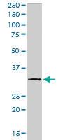 Anti-TIRAP Goat Polyclonal Antibody