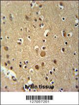 Anti-TNIP3 Rabbit Polyclonal Antibody (FITC (Fluorescein Isothiocyanate))