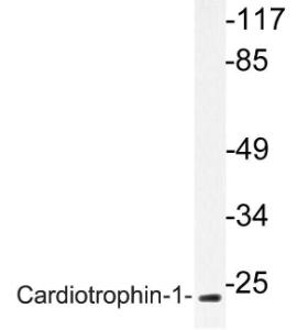 Western blot analysis of lysate from HUVEC cells using Anti-Cardiotrophin-1 Antibody