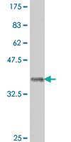 Anti-POLRMT Mouse Polyclonal Antibody