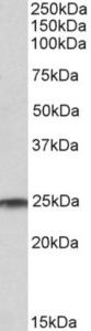 EB10644 (1 µg/ml) staining of Human Testis lysate (35 µg protein in RIPA buffer). Primary incubation was 1 hour. Detected by chemiluminescence.