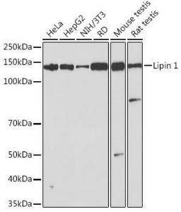 Anti-Lipin 1 Rabbit Monoclonal Antibody [clone: ARC1945]