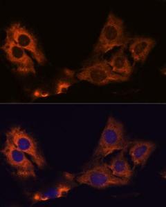 Immunofluorescence analysis of C6 cells using Anti-SMAP1 Antibody (A305769) at a dilution of 1:100 DAPI was used to stain the cell nuclei (blue)