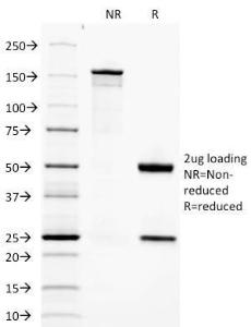 SDS-PAGE analysis of Anti-Adiponectin Antibody [ADPN/1370] under non-reduced and reduced conditions; showing intact IgG and intact heavy and light chains, respectively. SDS-PAGE analysis confirms the integrity and purity of the antibody.