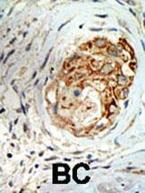 Anti-MBD3 Rabbit Polyclonal Antibody