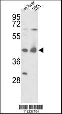 Anti-XPA Rabbit Polyclonal Antibody