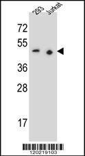 Anti-PAX9 Rabbit Polyclonal Antibody (APC (Allophycocyanin))