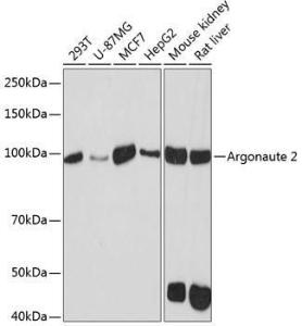 Anti-Argonaute-2 Rabbit Monoclonal Antibody [clone: ARC0189]