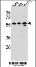 Anti-TRIM4 Rabbit Polyclonal Antibody