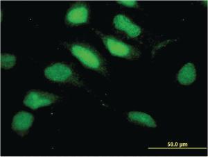 Anti-RNF113A Mouse Monoclonal Antibody [clone: 3F3]