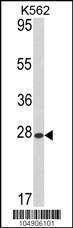 Anti-ARL1 Rabbit Polyclonal Antibody (AP (Alkaline Phosphatase))