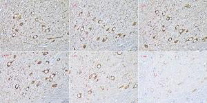 Immunohistochemistry analysis of paraffin-embedded mouse brain using Donkey Anti-Mouse IgG H&L Antibody (HRP) (A17351) at a dilution of 1:20 - 1:800 (40X lens). Perform high pressure antigen retrieval with 10 mM citrate buffer pH 6.0 before commencing with IHC staining protocol