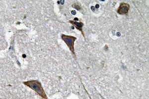 Immunohistochemical analysis of paraffin-embedded human brain tissue using Anti-Ob-R Antibody