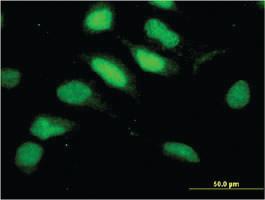 Anti-RNF113A Mouse Monoclonal Antibody [clone: 3F3]