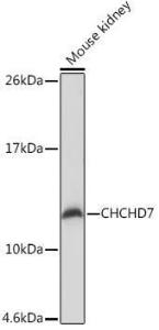 Western blot analysis of extracts of Mouse kidney, using Anti-CHCHD7 Antibody (A307420) at 1:1,000 dilution. The secondary antibody was Goat Anti-Rabbit IgG H&L Antibody (HRP) at 1:10,000 dilution.