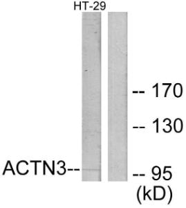 Western blot analysis of lysates from HT-29 cells using Anti-ACTN3 Antibody. The right hand lane represents a negative control, where the antibody is blocked by the immunising peptide.