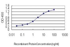 Anti-LDLR Mouse Monoclonal Antibody [clone: 5E7]