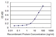 Anti-RNF113A Mouse Monoclonal Antibody [clone: 3F3]