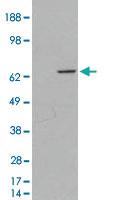 Anti-MTM1 Goat Polyclonal Antibody