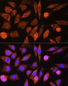 Immunofluorescence analysis of L929 cells using Anti-CHCHD7 Antibody (A307420) at a dilution of 1:100. DAPI was used to stain the cell nuclei (blue).