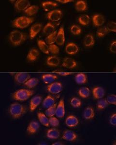 Immunofluorescence analysis of HeLa cells using Anti-SMAP1 Antibody (A305769) at a dilution of 1:100 DAPI was used to stain the cell nuclei (blue)