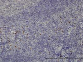 Anti-TCF12 Mouse Monoclonal Antibody [clone: 2E9]