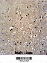 Anti-PAPD4 Rabbit Polyclonal Antibody