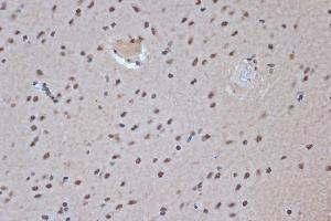 Immunohistochemistry analysis of paraffin-embedded rat brain using Anti-SRSF3 Antibody [ARC1394] (A307421) at a dilution of 1:100 (40X lens). Perform microwave antigen retrieval with 10 mM Tris/EDTA buffer pH 9.0 before commencing with IHC staining protocol