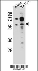 Anti-TRIM62 Rabbit Polyclonal Antibody