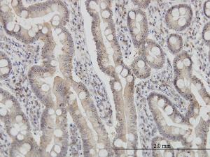 Anti-FIS1 Mouse Monoclonal Antibody [clone: 1G9]