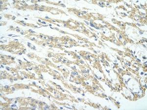 Anti-PHF11 Rabbit Polyclonal Antibody