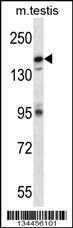 Anti-CDK13 Rabbit Polyclonal Antibody (HRP (Horseradish Peroxidase))