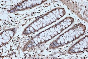 Immunohistochemistry analysis of paraffin-embedded human colon tissue using Anti-SRSF3 Antibody [ARC1394] (A307421) at a dilution of 1:100 (40X lens). Perform microwave antigen retrieval with 10 mM Tris/EDTA buffer pH 9.0 before commencing with IHC staining protocol