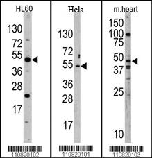 Anti-JMJD6 Rabbit Polyclonal Antibody