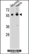 Anti-TRIM64 Rabbit Polyclonal Antibody