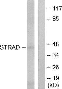 Western blot analysis of lysates from HepG2 cells using Anti-STRAD Antibody The right hand lane represents a negative control, where the antibody is blocked by the immunising peptide