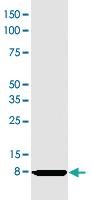 Anti-CXCL8 Mouse Monoclonal Antibody [clone: I8-60]