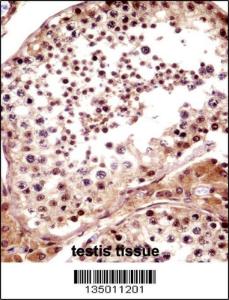 Anti-TNKS Rabbit Polyclonal Antibody