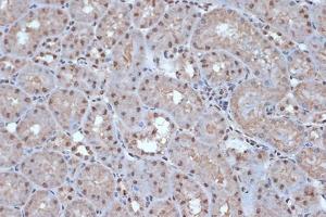 Immunohistochemistry analysis of paraffin-embedded mouse kidney using Anti-SRSF3 Antibody [ARC1394] (A307421) at a dilution of 1:100 (40X lens). Perform microwave antigen retrieval with 10 mM Tris/EDTA buffer pH 9.0 before commencing with IHC staining protocol